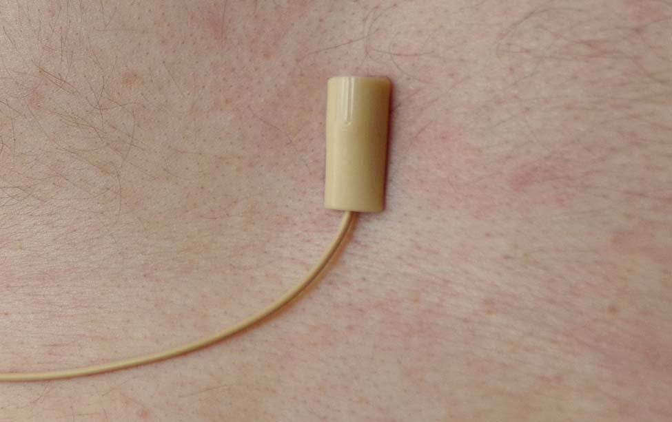 URSA STRAPS minimount, 4060